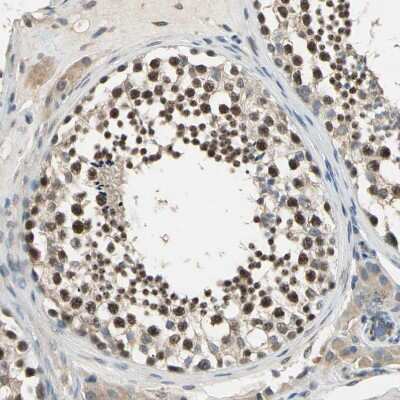 Immunohistochemistry-Paraffin: FAM208A Antibody [NBP1-90672]