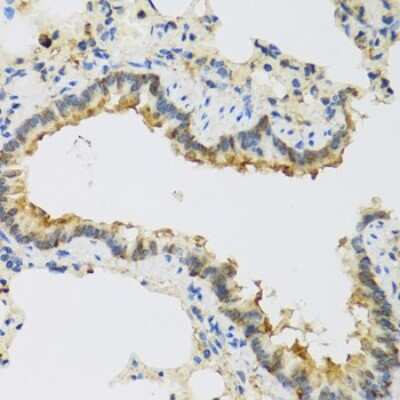 Immunohistochemistry-Paraffin: FAM20A Antibody - BSA Free [NBP3-04714]
