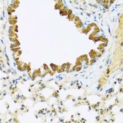 Immunohistochemistry-Paraffin: FAM20A Antibody - BSA Free [NBP3-04714]
