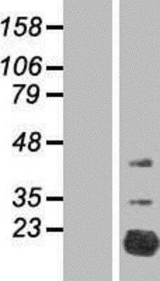 Western Blot: FAM210A Overexpression Lysate [NBP2-05391]