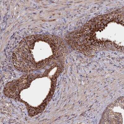 Immunohistochemistry-Paraffin: FAM210B Antibody [NBP2-14523]