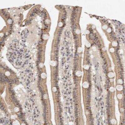 Immunohistochemistry: FAM211A Antibody [NBP1-93828]