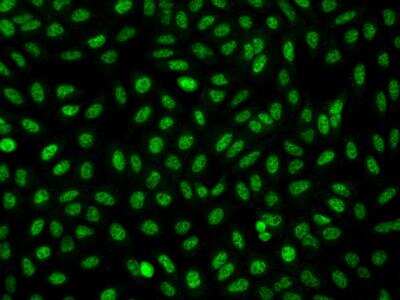 Immunocytochemistry/ Immunofluorescence: FAM212A Antibody [NBP3-05938]