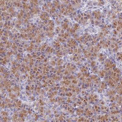 Immunohistochemistry-Paraffin: FAM212A Antibody [NBP1-86222]