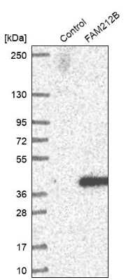 Western Blot: FAM212B Antibody [NBP1-93888]