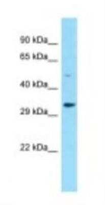 Western Blot: FAM212B Antibody [NBP1-98266]