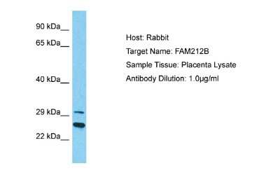 Western Blot: FAM212B Antibody [NBP2-87414]