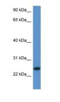 Western Blot: FAM213B Antibody [NBP1-91435]