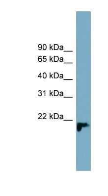 Western Blot: FAM213B Antibody [NBP1-91436]