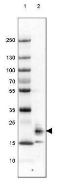 Western Blot: FAM213B Antibody [NBP1-93498]