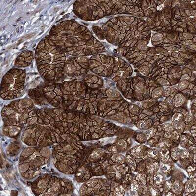 Immunohistochemistry-Paraffin: FAM214A Antibody [NBP1-83797]