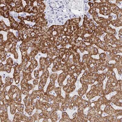 Immunohistochemistry: FAM214B Antibody [NBP2-38767]