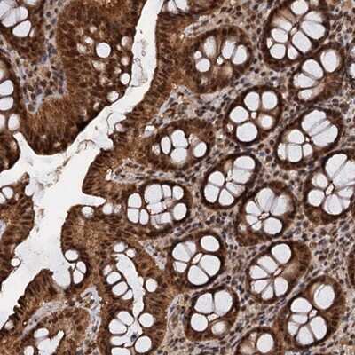 Immunohistochemistry-Paraffin: FAM216B Antibody [NBP1-83448]