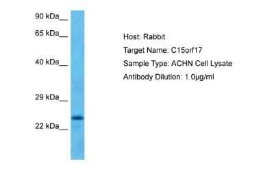 Western Blot: FAM219B Antibody [NBP2-84911]