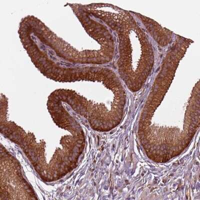 Immunocytochemistry/ Immunofluorescence: FAM21A Antibody [NBP2-68768]