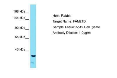 Western Blot: FAM21A Antibody [NBP2-87416]