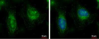 Immunocytochemistry/ Immunofluorescence: FAM21C Antibody [NBP2-43534]