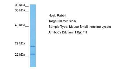 Western Blot: FAM220A Antibody [NBP2-82667]