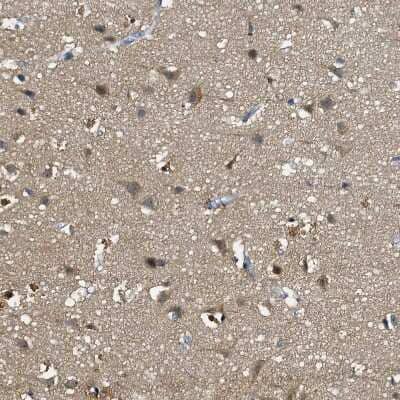 Immunohistochemistry-Paraffin: FAM222A Antibody [NBP1-82225]