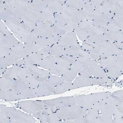 Immunohistochemistry-Paraffin: FAM222A Antibody [NBP1-82225]