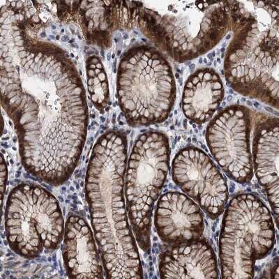 Immunohistochemistry-Paraffin: FAM222A Antibody [NBP1-82225]