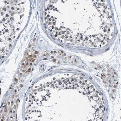 Immunohistochemistry-Paraffin: FAM222A Antibody [NBP1-82225]