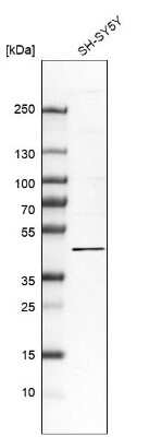 Western Blot: FAM222A Antibody [NBP1-82225]