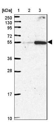 Western Blot: FAM222B Antibody [NBP2-14388]