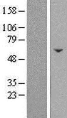 Western Blot: FAM222B Overexpression Lysate [NBP2-09263]