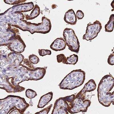 Immunohistochemistry-Paraffin: FAM227B Antibody [NBP2-14690]