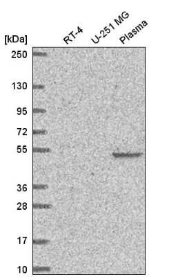 Western Blot: FAM227B Antibody [NBP2-56416]