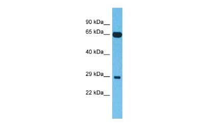 Western Blot: FAM227B Antibody [NBP2-84915]