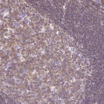 Immunohistochemistry: FAM228B Antibody [NBP2-49051]