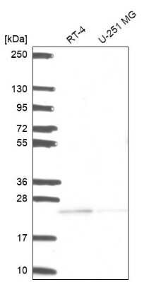 Western Blot: FAM228B Antibody [NBP2-49051]