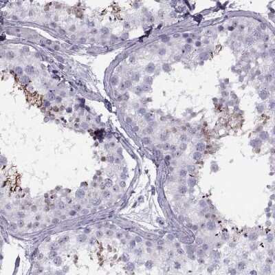 Immunohistochemistry-Paraffin: FAM24B Antibody [NBP2-33650]