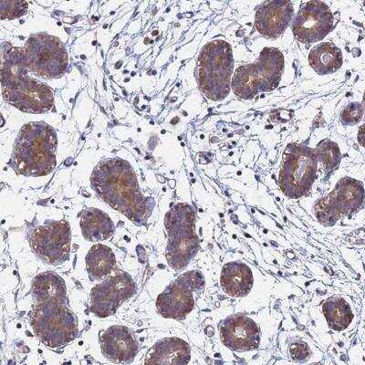 Immunohistochemistry-Paraffin: FAM25A Antibody [NBP2-59791]