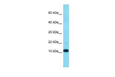 Western Blot: FAM25A Antibody [NBP2-82677]