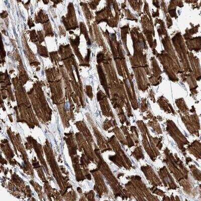 Immunohistochemistry-Paraffin: FAM26E Antibody [NBP1-91162]