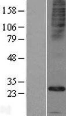 Western Blot: FAM26E Overexpression Lysate [NBP2-05231]