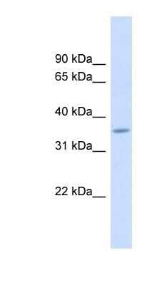 Western Blot: FAM26F Antibody [NBP1-80539]