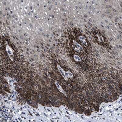 Immunohistochemistry-Paraffin: FAM29A Antibody [NBP1-88021]