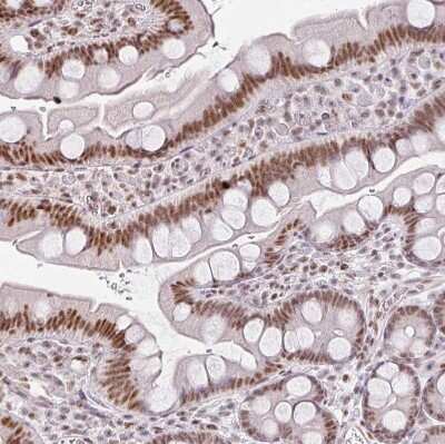 Immunohistochemistry-Paraffin: FAM32A Antibody [NBP2-30704]