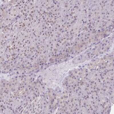Immunohistochemistry-Paraffin: FAM32A Antibody [NBP2-30704]
