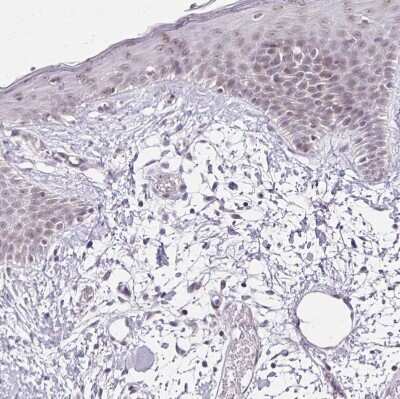 Immunohistochemistry-Paraffin: FAM32A Antibody [NBP2-30704]