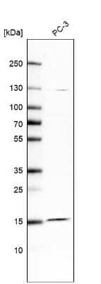 Western Blot: FAM32A Antibody [NBP2-30704]