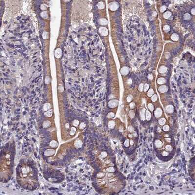 Immunohistochemistry-Paraffin: FAM36A Antibody [NBP1-91886]