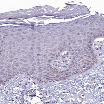 Immunohistochemistry-Paraffin: FAM36A Antibody [NBP1-91886]