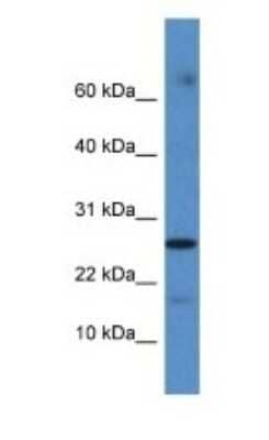 Western Blot: FAM36A Antibody [NBP1-79529]