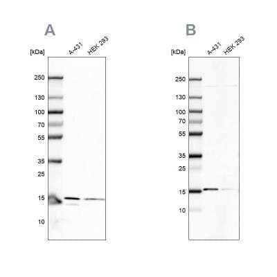 Western Blot: FAM36A Antibody [NBP1-91885]