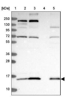 Western Blot: FAM36A Antibody [NBP1-91886]